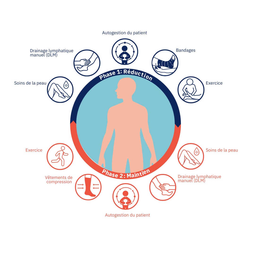 Schéma montrant les deux phases de la thérapie décongestive complexe/complète et leurs éléments. Schéma montrant les deux phases de la thérapie décongestive complexe/complète et leurs éléments.